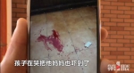 天降横祸!楼房外墙瓷砖脱落 5岁男孩被砸成重伤 - 重庆晨网