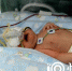产妇深夜在楼道分娩，这场三条生命的抢救接力，他们都拼了！ - 重庆晨网