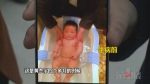 1岁男童腹泻8月仍不见好 骨瘦如柴 - 重庆晨网