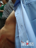 停车起争执，一摊贩持刀伤人后自首 - 重庆晨网