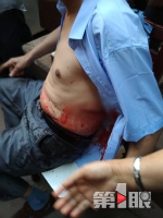 停车起争执，一摊贩持刀伤人后自首 - 重庆晨网