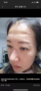 这张重庆护师的对比照刷屏后，母亲才知女儿去了疫情一线！ - 重庆晨网