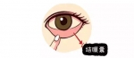 居家消毒别忘护眼！眼科专家教你眼睛防护法 - 重庆晨网