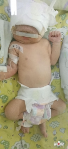 重庆新冠肺炎患者产下的女婴 第一次核酸检测结果为阴性 - 重庆晨网