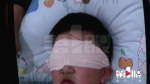 痛心！小男孩钟爱的小玩具 让他右眼受重伤 - 重庆晨网