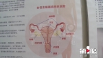 备孕二胎数月无动静？女子检查发现十个月前取的环仍在体内 - 重庆晨网