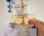 4岁半儿子输液过半发现药物已过期，万州这家医院被立案调查！ - 重庆晨网