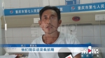 手机揣裤兜自燃 男子大腿被烧伤裤子被烧穿 - 重庆晨网